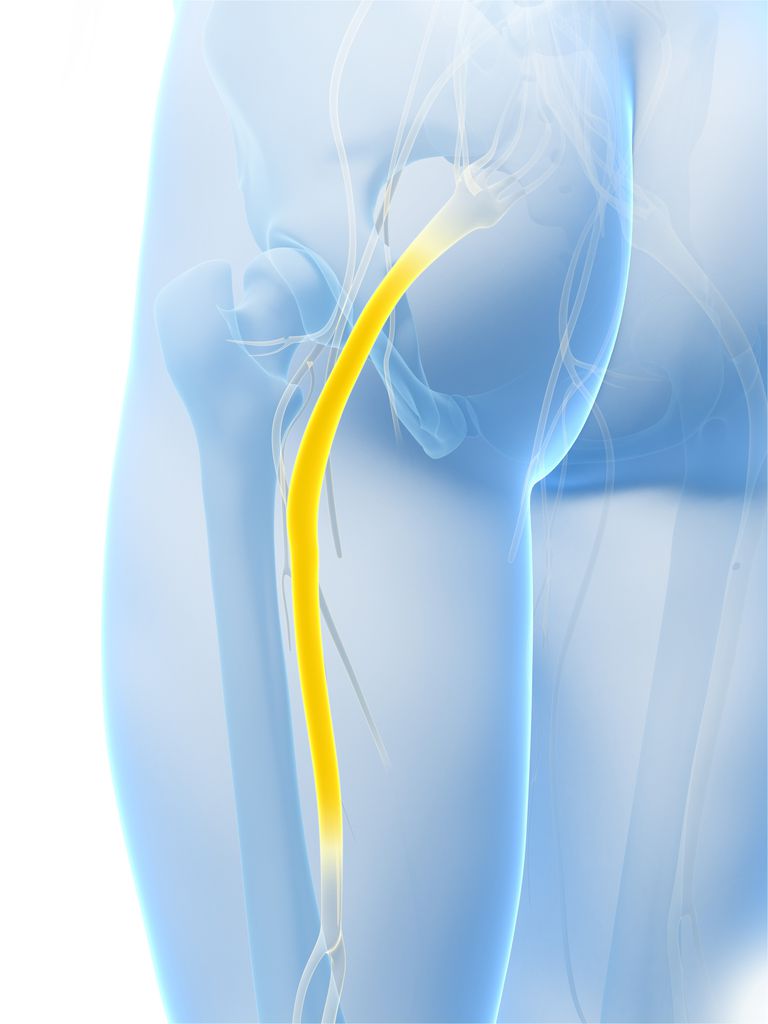 sciatic nerve, dine hamstrings, motion iskias, strække sciatic, strække sciatic nerve, dårlig form