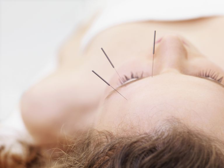 alternativ behandling, Dette punkt, Nogle gange, akupunktur Akupunktur