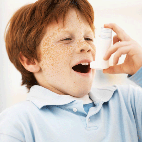 allergisk astma, ​​allergisk astma, airway remodeling, allergier astma