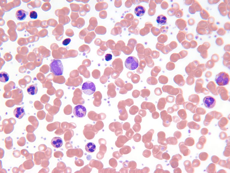 hvide blodlegemer, Killer T-celler, amerikanske kræftsamfund, blev opdaget