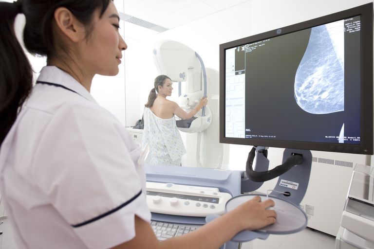 arteriel forkalkning, digital mammografi, mammografi viste, ændrer vores