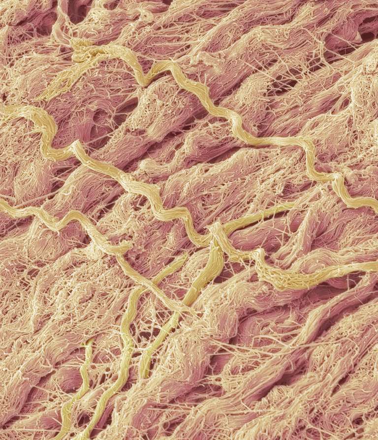 ekstracellulære matrix, uregelmæssigt bindevæv, bindevæv indeholder, elastiske fibre, fibre opløselige