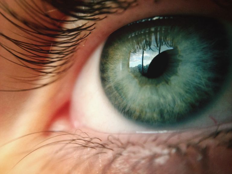 dine øjne, udiagnostiseret eller, ikke reagerer, underaktiv skjoldbruskkirtlen, ofte forbundet, symptomer udiagnostiseret