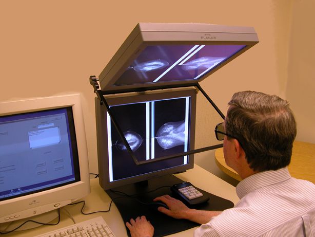 digital mammografi, Cancer Institute, digitale mammogrammer, National Cancer
