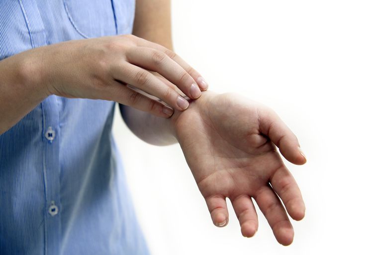 dyshidrotisk dermatitis, atopisk dermatitis, hænder fødder