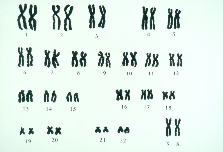 Downs syndrom, FISH-analyse karyotype, alle kromosomer, eller chorionisk, giver information
