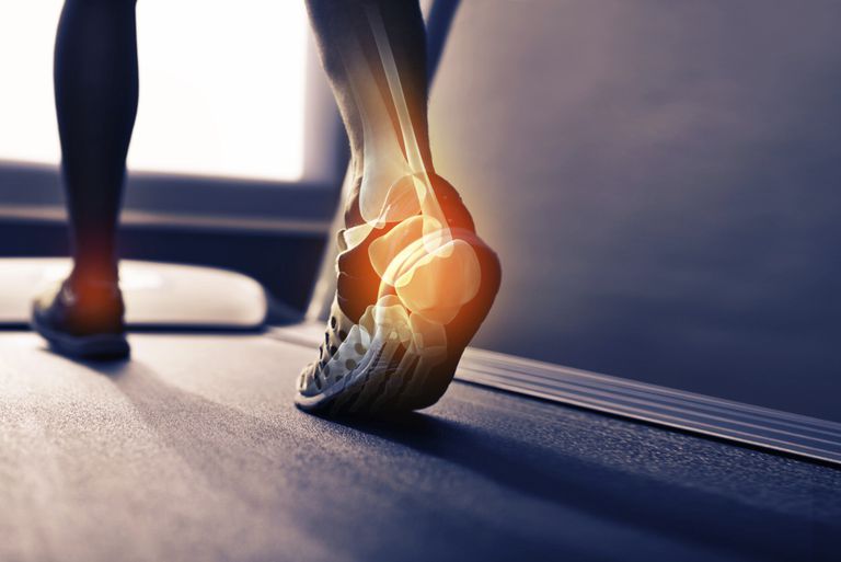 Achilles tendonitis, Dette resulterer, forstuvet ankel, skade vigtigt