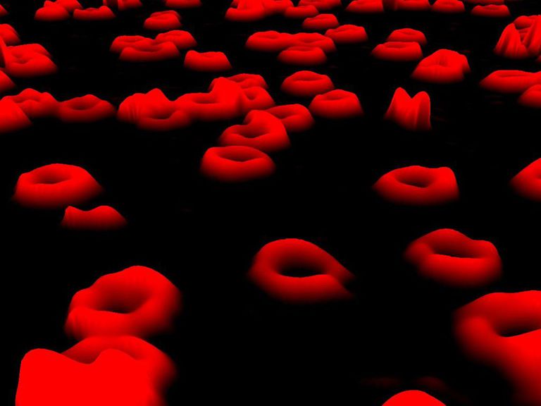 røde blodlegemer, lavt hæmoglobinniveau, anæmi eller, bestemme årsagen, celle anæmi, enten grund