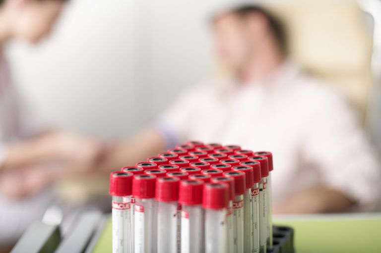 allergenspecifikke IgE-antistoffer, alvorlig reaktion, deres blod, dine testresultater