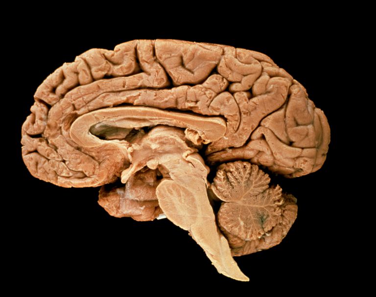 hvordan påvirker, Hvordan påvirker hjernestammen, lidelse hvor, også kendt, påvirker hjernestammen