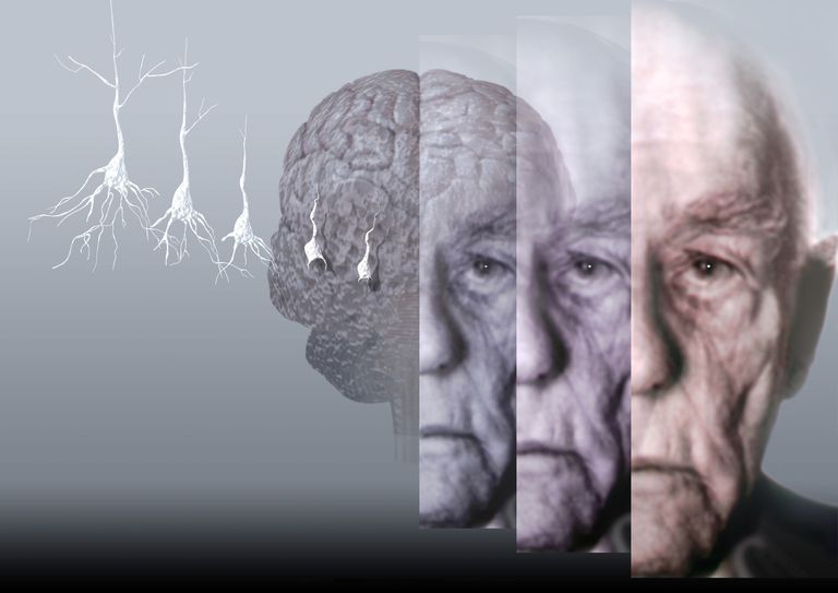 udfordrende adfærd, Alzheimers sygdom, eller forhindre, hvordan person, A-B-C adfærdskæden