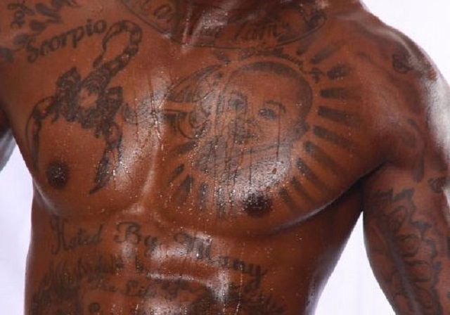 tatovering fjernelse, laser tatovering, laser tatovering fjernelse, andre metoder, fjerne tatovering, fjernelse laser