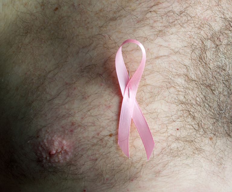 mandlig brystkræft, Klinefelter syndrom, American Cancer, American Cancer Society, brystkræft Klinefelter, brystkræft Klinefelter syndrom