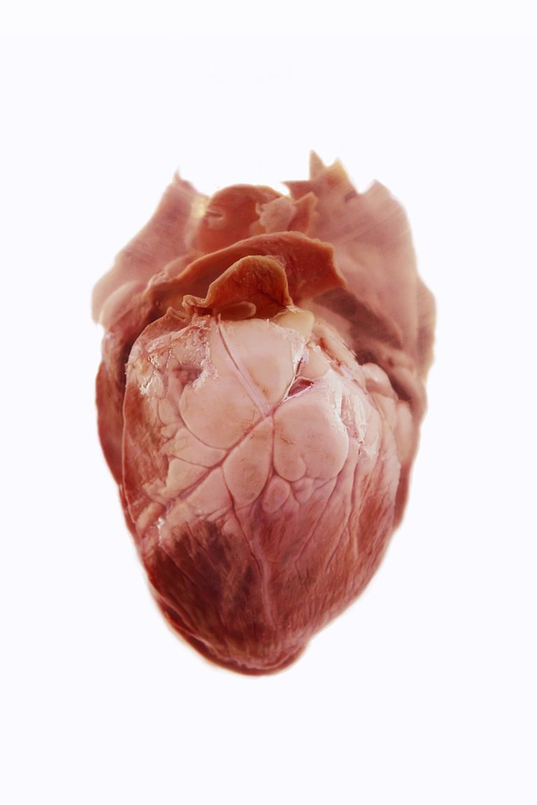 MUGA-scanningen giver, andre teknikker, hjertets overordnede, MUGA-scanningen særlig