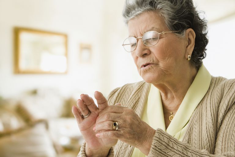 slidgigt Slidgigt, forbindelse slidgigt, mest almindelige, rheumatoid arthritis