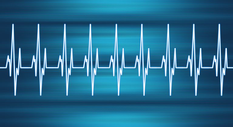 hjertets elektriske, atria ventriklerne, elektriske impuls, elektriske impulser, elektriske system, hjertets elektriske system