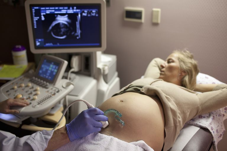 intrauterin slagtilfælde, slagtilfælde fødslen, fødslen ikke, graviditet eller