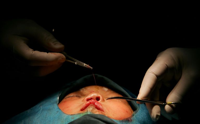 kosmetisk kirurgi, omfatter følgende, procedurer omfatter