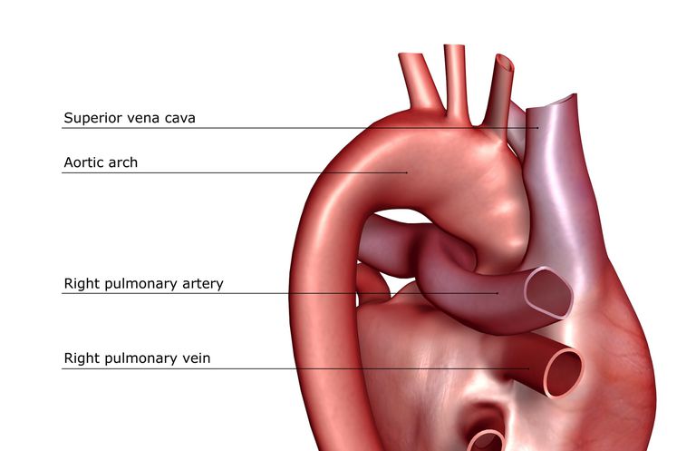 vores hjerte, arteriel hypertension, andre tilstande, andre tilstande såsom