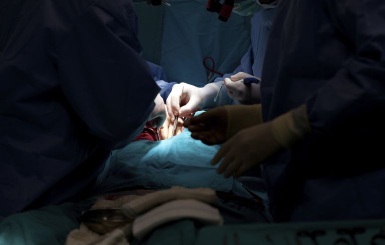 bypass kirurgi, efter operationen, artery bypass