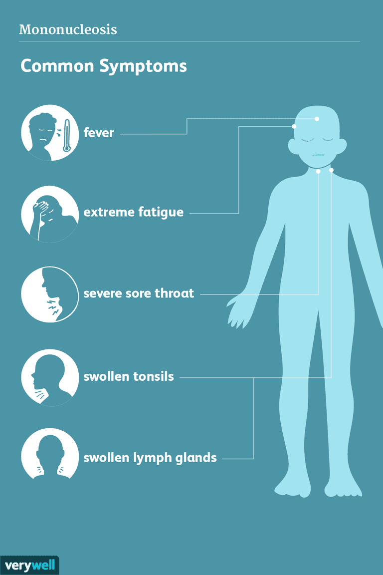milde symptomer, ondt halsen, ældre voksne, andre sygdomme, forstørrede mandler, halsen eller