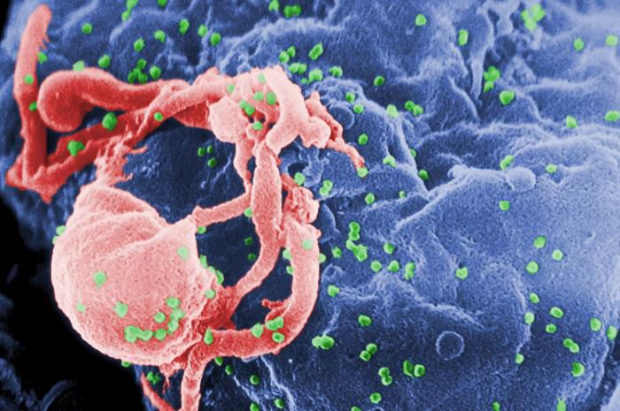 kliniske forsøg, AIDS Vaccine, begynder første, AIDS Vaccine Evaluation