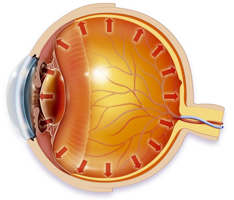 efter operationen, forhindre infektion, øjendråber forhindre, øjendråber forhindre infektion