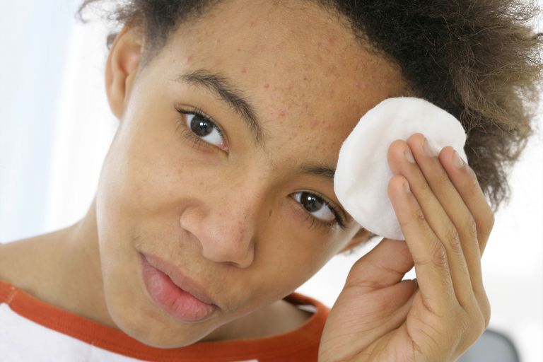 behandle acne, Minocyclin ikke, orale antibiotika, anvendes behandling