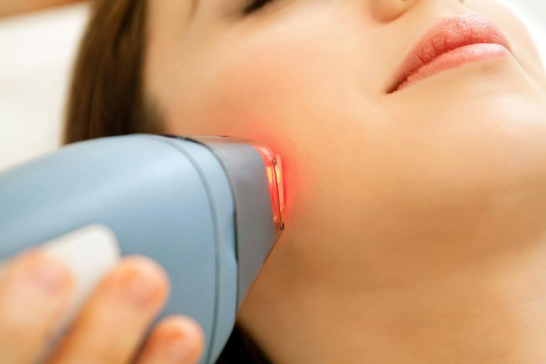 typer lasere, behandlinger såsom, kosmetiske anvendelser, lysbaserede behandlinger