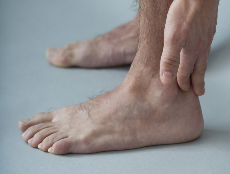 tibial tendonitis, aktivitet eller, berørte sene, mest almindelige, posterior tibial tendonitis