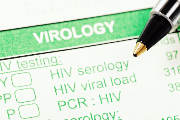 denne test, primære test, typer hiv-test, Western Blot-resultater uklare, Assay Denne