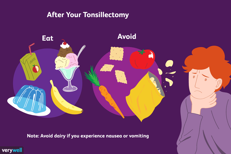 efter operationen, efter tonsillektomi, spise efter, spise efter tonsillektomi