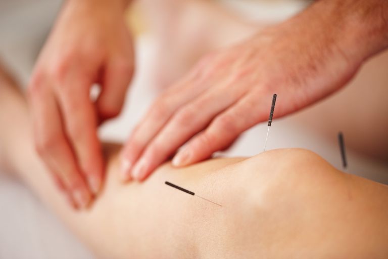 sundhedsmæssige problemer, akupunktur nåle, Akupunktur siges, blødning eller, blødning eller mærker, eller mærker