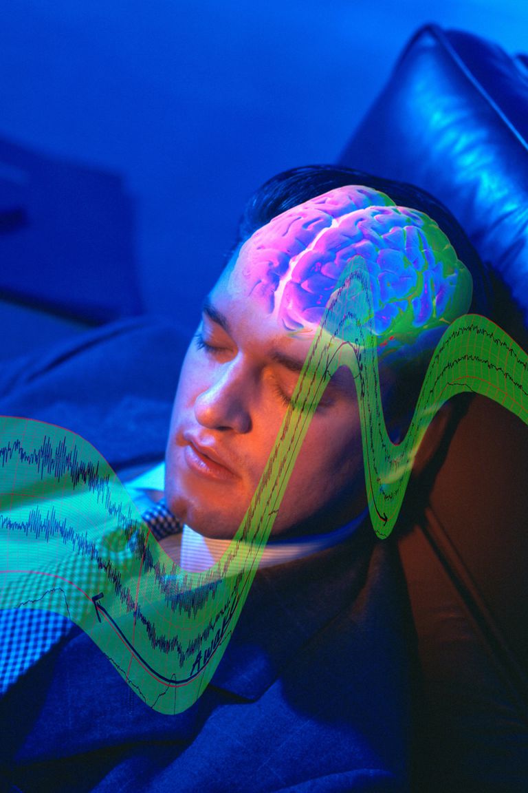 øjenbevægelses søvn, bruges vurdere, elektriske mønstre, hurtig øjenbevægelses