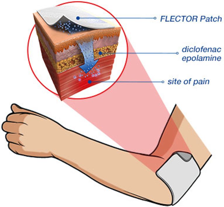 Flector patch, Flector patch ikke, ikke bruge, patch ikke, anti-inflammatorisk NSAID, anti-inflammatorisk NSAID medicin