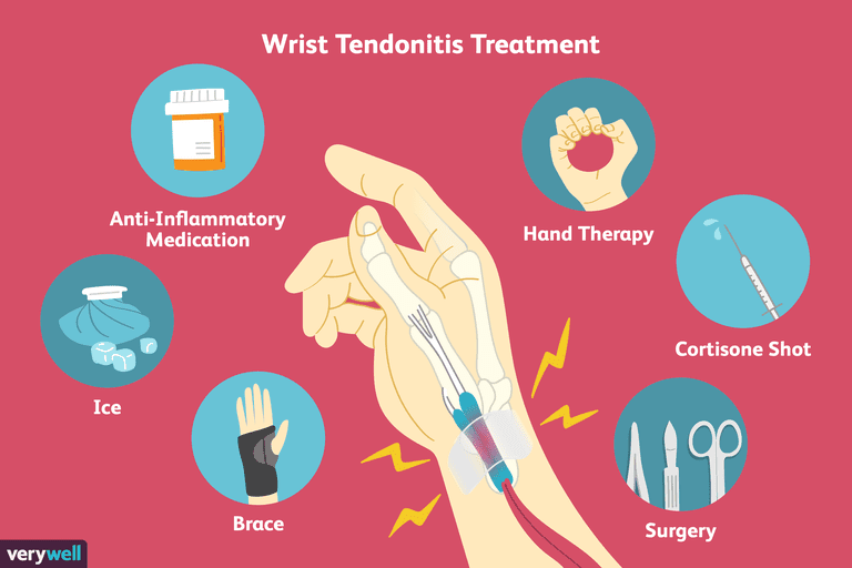 håndled tendonitis, omkring håndleddet, Wrist tendonitis, enkle trin, nogle enkle, nogle enkle trin